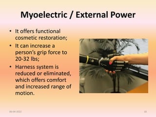 Myoelectric / External Power
• It offers functional
cosmetic restoration;
• It can increase a
person’s grip force to
20-32 lbs;
• Harness system is
reduced or eliminated,
which offers comfort
and increased range of
motion.
06-04-2022 18
 