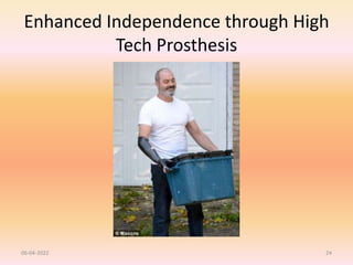 Enhanced Independence through High
Tech Prosthesis
06-04-2022 24
 