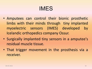 IMES
• Amputees can control their bionic prosthetic
limbs with their minds through tiny implanted
myoelectric sensors (IMES) developed by
Icelandic orthopedics company Ossur.
• Surgically implanted tiny sensors in a amputee's
residual muscle tissue.
• That trigger movement in the prosthesis via a
receiver.
06-04-2022 30
 