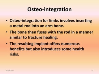 Osteo-integration
• Osteo-integration for limbs involves inserting
a metal rod into an arm bone.
• The bone then fuses with the rod in a manner
similar to fracture healing.
• The resulting implant offers numerous
benefits but also introduces some health
risks.
06-04-2022 31
 