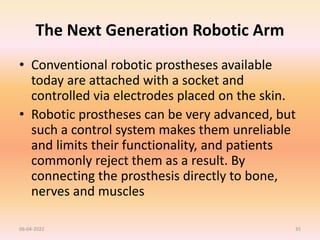 The Next Generation Robotic Arm
• Conventional robotic prostheses available
today are attached with a socket and
controlled via electrodes placed on the skin.
• Robotic prostheses can be very advanced, but
such a control system makes them unreliable
and limits their functionality, and patients
commonly reject them as a result. By
connecting the prosthesis directly to bone,
nerves and muscles
06-04-2022 35
 
