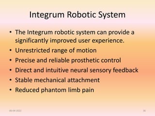 Integrum Robotic System
• The Integrum robotic system can provide a
significantly improved user experience.
• Unrestricted range of motion
• Precise and reliable prosthetic control
• Direct and intuitive neural sensory feedback
• Stable mechanical attachment
• Reduced phantom limb pain
06-04-2022 36
 