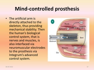 Mind-controlled prosthesis
• The artificial arm is
directly attached to the
skeleton, thus providing
mechanical stability. Then
the human’s biological
control system, that is
nerves and muscles, is
also interfaced via
neuromuscular electrodes
to the prosthesis via
Integrum’s advanced
control system.
06-04-2022 37
 