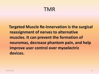 TMR
Targeted Muscle Re-innervation is the surgical
reassignment of nerves to alternative
muscles. It can prevent the formation of
neuromas, decrease phantom pain, and help
improve user control over myoelectric
devices.
06-04-2022 41
 