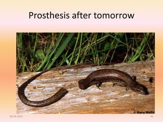 Prosthesis after tomorrow
06-04-2022 46
 