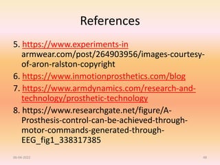 References
5. https://www.experiments-in
armwear.com/post/264903956/images-courtesy-
of-aron-ralston-copyright
6. https://www.inmotionprosthetics.com/blog
7. https://www.armdynamics.com/research-and-
technology/prosthetic-technology
8. https://www.researchgate.net/figure/A-
Prosthesis-control-can-be-achieved-through-
motor-commands-generated-through-
EEG_fig1_338317385
06-04-2022 48
 