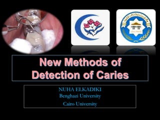 New Methods of
Detection of Caries
NUHA ELKADIKI
Benghazi University
Cairo University
 