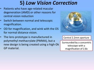Advance research & development in contact lens by jasmin (Raees Optom ...