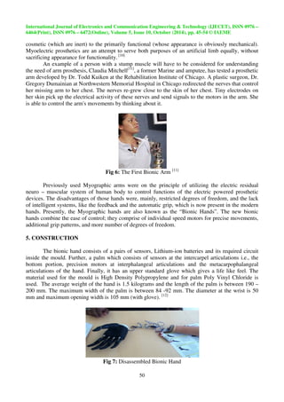 International Journal of Electronics and Communication Engineering  Technology (IJECET), ISSN 0976 – 
6464(Print), ISSN 0976 – 6472(Online), Volume 5, Issue 10, October (2014), pp. 45-54 © IAEME 
cosmetic (which are inert) to the primarily functional (whose appearance is obviously mechanical). 
Myoelectric prosthetics are an attempt to serve both purposes of an artificial limb equally, without 
sacrificing appearance for functionality. [10] 
50 
 
An example of a person with a stump muscle will have to be considered for understanding 
the need of arm prosthesis, Claudia Mitchell[11], a former Marine and amputee, has tested a prosthetic 
arm developed by Dr. Todd Kuiken at the Rehabilitation Institute of Chicago. A plastic surgeon, Dr. 
Gregory Dumainian at Northwestern Memorial Hospital in Chicago redirected the nerves that control 
her missing arm to her chest. The nerves re-grew close to the skin of her chest. Tiny electrodes on 
her skin pick up the electrical activity of these nerves and send signals to the motors in the arm. She 
is able to control the arm's movements by thinking about it. 
Fig 6: The First Bionic Arm [11] 
Previously used Myographic arms were on the principle of utilizing the electric residual 
neuro – muscular system of human body to control functions of the electric powered prosthetic 
devices. The disadvantages of those hands were, mainly, restricted degrees of freedom, and the lack 
of intelligent systems, like the feedback and the automatic grip, which is now present in the modern 
hands. Presently, the Myographic hands are also known as the “Bionic Hands”. The new bionic 
hands combine the ease of control; they comprise of individual speed motors for precise movements, 
additional grip patterns, and more number of degrees of freedom. 
5. CONSTRUCTION 
The bionic hand consists of a pairs of sensors, Lithium-ion batteries and its required circuit 
inside the mould. Further, a palm which consists of sensors at the intercarpel articulations i.e., the 
bottom portion, precision motors at interphalangeal articulations and the metacarpophalangeal 
articulations of the hand. Finally, it has an upper standard glove which gives a life like feel. The 
material used for the mould is High Density Polypropylene and for palm Poly Vinyl Chloride is 
used. The average weight of the hand is 1.5 kilograms and the length of the palm is between 190 – 
200 mm. The maximum width of the palm is between 84 -92 mm. The diameter at the wrist is 50 
mm and maximum opening width is 105 mm (with glove). [12] 
Fig 7: Disassembled Bionic Hand 
 