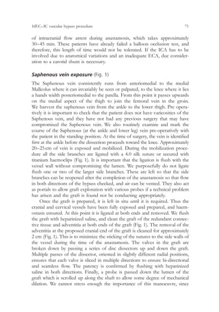 Advances and technical standards in neurosurgery | PDF