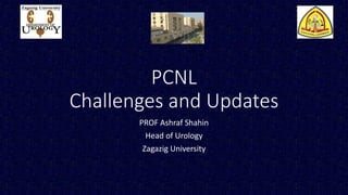 PCNL
Challenges and Updates
PROF Ashraf Shahin
Head of Urology
Zagazig University
 
