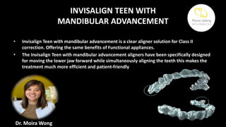 ADVANCES IN ALIGNER TREATMENT | PPTX