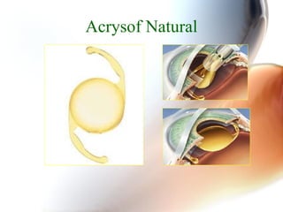 Advances in cataract surgery | PPT