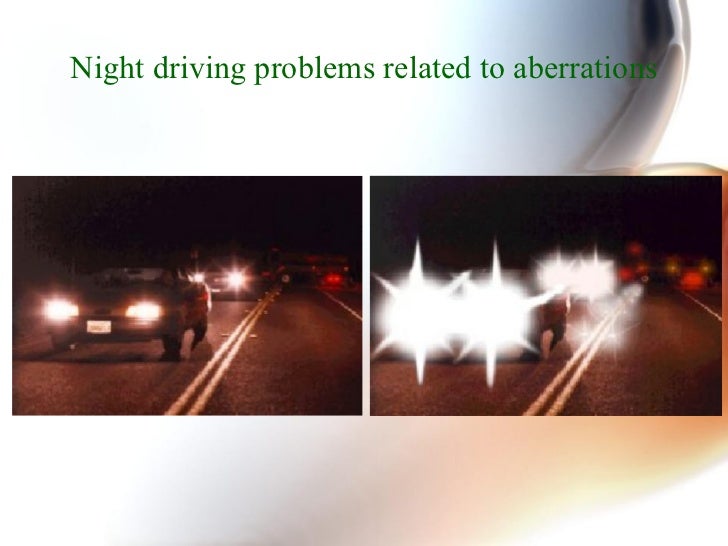 Advances in cataract surgery