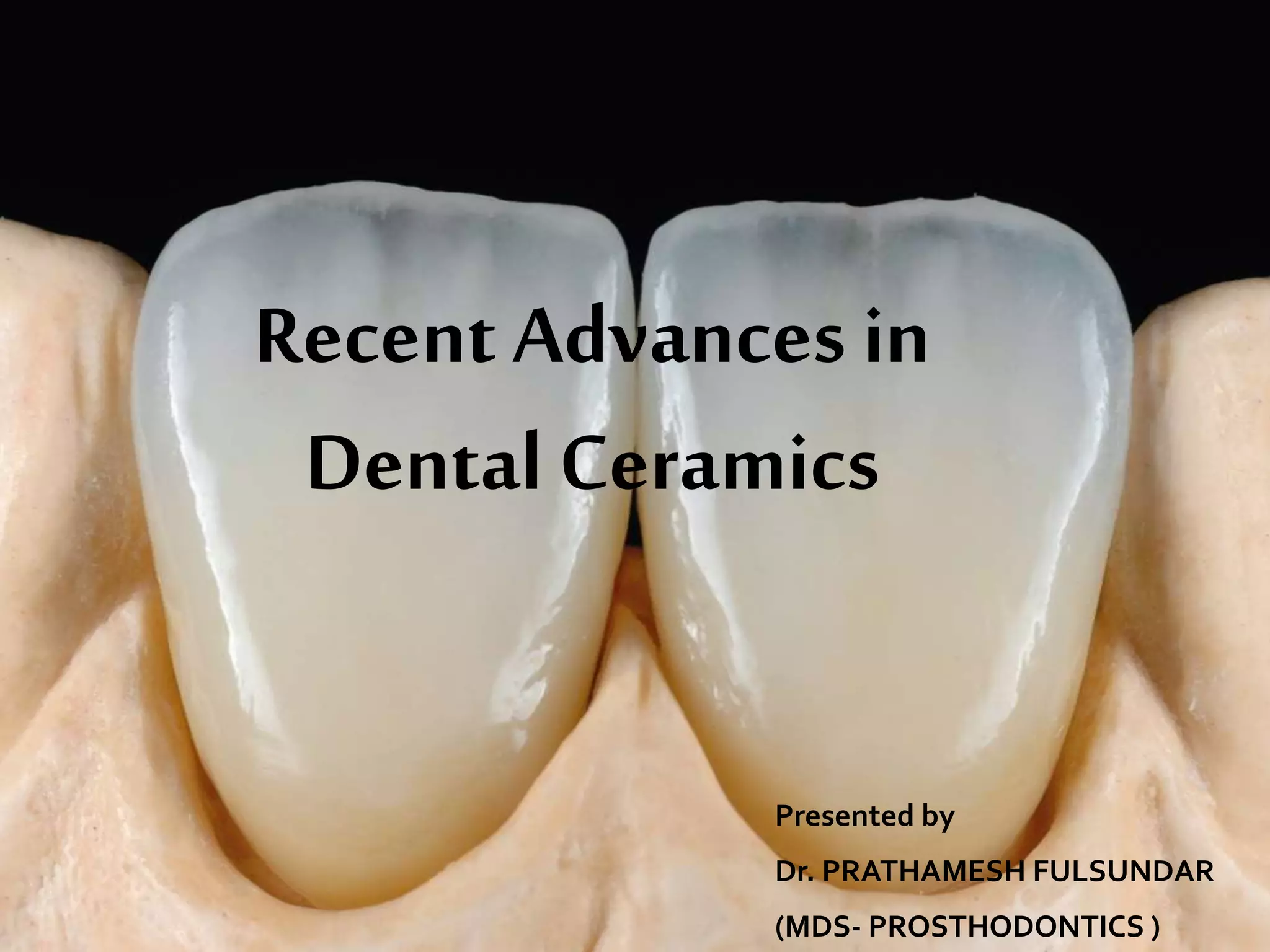 Recent Advances in Dental Ceramics | PPTX