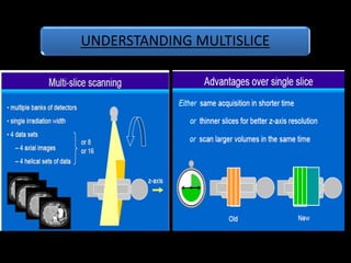 UNDERSTANDING MULTISLICE
 