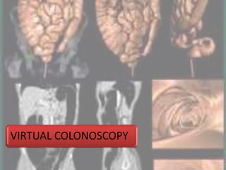 VIRTUAL COLONOSCOPY
 