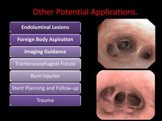 Endoluminal Lesions
Foreign Body Aspiration
Imaging Guidance
Tracheoesophageal Fistula
Burn Injuries
Stent Planning and Follow-up
Trauma
Other Potential Applications.
 