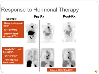 Advances in Diagnosis & Imaging Impacting Cancer Treatment | PDF
