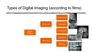 Types of Digital Imaging (according to films)
Digital
Imaging
Extra oral
Cephalometric
Panoramic
Tomographic
Intra oral
Periapical
Bitewing
 