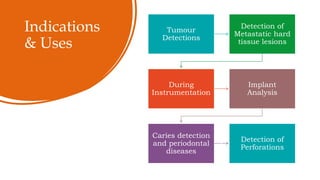 Indications
& Uses
Tumour
Detections
Detection of
Metastatic hard
tissue lesions
During
Instrumentation
Implant
Analysis
Caries detection
and periodontal
diseases
Detection of
Perforations
 