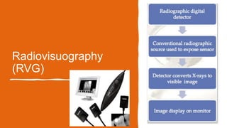 Radiovisuography
(RVG)
 