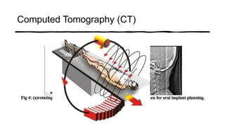 Computed Tomography (CT)
 