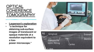 OPTICAL
COHERENCE
TOMOGRAPHY
• Layperson's explanation
• “a technique for
obtaining sub-surface
images of translucent or
opaque materials at a
resolution equivalent to
a low-
power microscope.”
 
