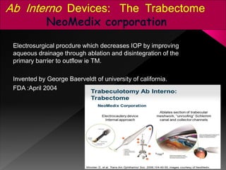 Advances in glaucoma surgeries | PPTX