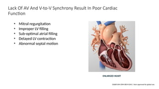 Poor Cardiac Function Advances in Heart Failure_Drugs to Devices.pptx