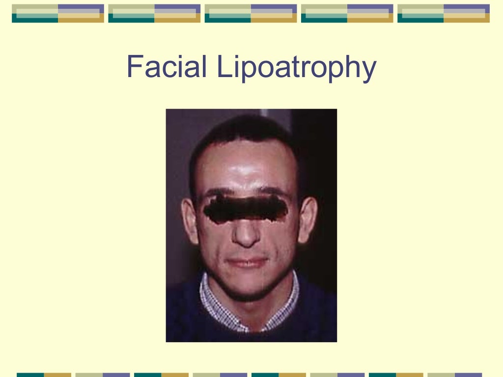 Advances in hiv treatment