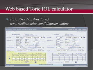 iol reference online Images High Quality Grahic Advances in iol calculation | PPTX