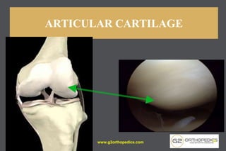 ARTICULAR CARTILAGE
www.g2orthopedics.com 11
 