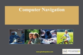 Computer Navigation
www.g2orthopedics.com 36
 