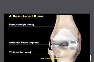 www.g2orthopedics.com
 