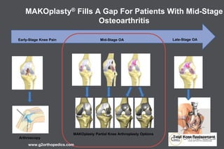 MAKOplasty® Fills A Gap For Patients With Mid-Stage
Osteoarthritis
Early-Stage Knee Pain Mid-Stage OA Late-Stage OA
MAKOplasty Partial Knee Arthroplasty Options
Total Knee ReplacementArthroscopy
www.g2orthopedics.com
 