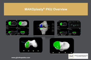 www.g2orthopedics.com
MAKOplasty® PKU Overview
 