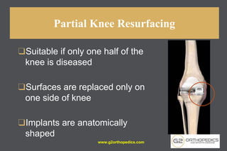 Partial Knee Resurfacing
❑Suitable if only one half of the
knee is diseased
❑Surfaces are replaced only on
one side of knee
❑Implants are anatomically
shaped
www.g2orthopedics.com
 