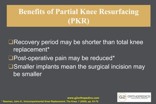 Benefits of Partial Knee Resurfacing
(PKR)
❑Recovery period may be shorter than total knee
replacement*
❑Post-operative pain may be reduced*
❑Smaller implants mean the surgical incision may
be smaller
* Newman, John H., Unicompartmental Knee Replacement, The Knee, 7 (2000), pp. 63-70.
www.g2orthopedics.com
 