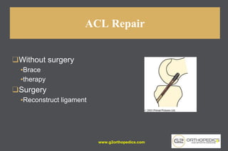 ACL Repair
❑Without surgery
▪Brace
▪therapy
❑Surgery
▪Reconstruct ligament
www.g2orthopedics.com 8
 