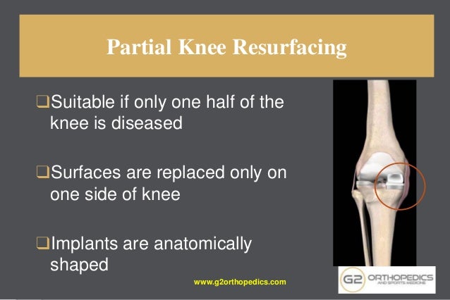 Advances in knee replacement 2015.pptx