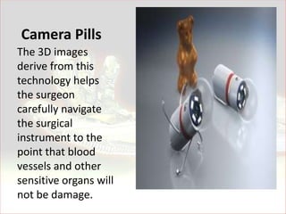 Camera Pills
The 3D images
derive from this
technology helps
the surgeon
carefully navigate
the surgical
instrument to the
point that blood
vessels and other
sensitive organs will
not be damage.
 