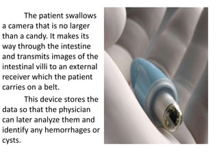 The patient swallows
a camera that is no larger
than a candy. It makes its
way through the intestine
and transmits images of the
intestinal villi to an external
receiver which the patient
carries on a belt.
       This device stores the
data so that the physician
can later analyze them and
identify any hemorrhages or
cysts.
 