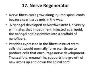 17. Nerve Regenerator
• Nerve fibers can't grow along injured spinal cords
  because scar tissue gets in the way.
• A nanogel developed at Northwestern University
  eliminates that impediment. Injected as a liquid,
  the nanogel self-assembles into a scaffold of
  nanofibers.
• Peptides expressed in the fibers instruct stem
  cells that would normally form scar tissue to
  produce cells that encourage nerve development.
  The scaffold, meanwhile, supports the growth of
  new axons up and down the spinal cord.
 