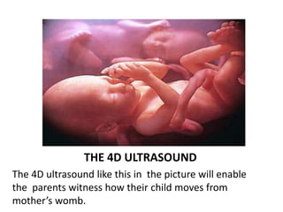 THE 4D ULTRASOUND
The 4D ultrasound like this in the picture will enable
the parents witness how their child moves from
mother’s womb.
 