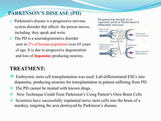 PARKINSON’S DISEASE (PD)
 Parkinson's disease is a progressive nervous
system disorder that affects the person moves,
including they speak and write.
 The PD is a neurodegenerative disorder
seen in 2% of human population over 65 years
of age. It is due to progressive degeneration
and loss of dopamine-producing neurons.
TREATMENT:
 Embryonic stem cell transplantation was used. Lab-differentiated ESCs into
dopamine, producing neurons for transplantation in patient suffering from PD.
 The PD cannot be treated with known drugs.
 New Technique Could Treat Parkinson’s Using Patient’s Own Brain Cells
 Scientists have successfully implanted nerve stem cells into the brain of a
monkey, targeting the area destroyed by Parkinson’s disease.
 