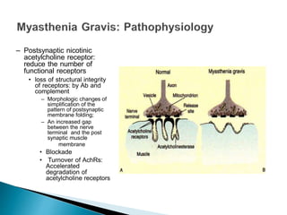 – Postsynaptic nicotinic
acetylcholine receptor:
reduce the number of
functional receptors
• loss of structural integrity
of receptors: by Ab and
complement
– Morphologic changes of
simplification of the
pattern of postsynaptic
membrane folding;
– An increased gap
between the nerve
terminal and the post
synaptic muscle
membrane
• Blockade
• Turnover of AchRs:
Accelerated
degradation of
acetylcholine receptors
 