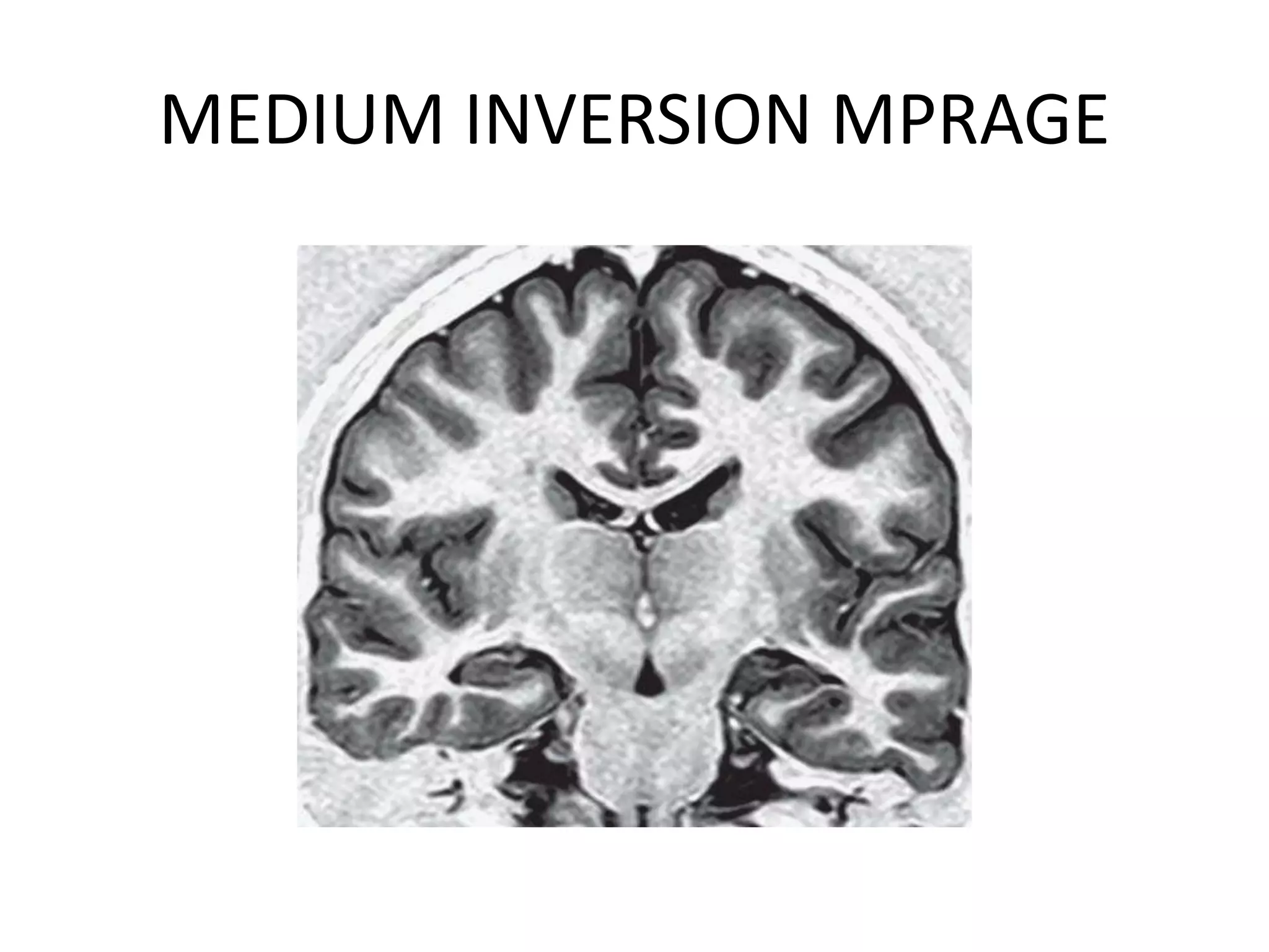 MEDIUM INVERSION MPRAGE
 
