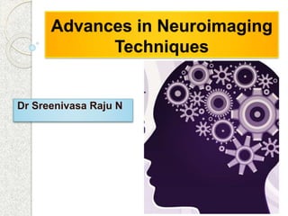 Advances in Neuroimaging
Techniques
Dr Sreenivasa Raju N
 