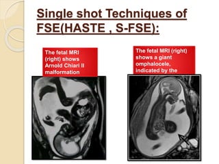Advances in neuroimaging techniques | PPTX